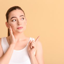 Une peau impeccable : les aliments à éviter pour combattre l'acné