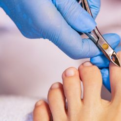 traiter un ongle incarné